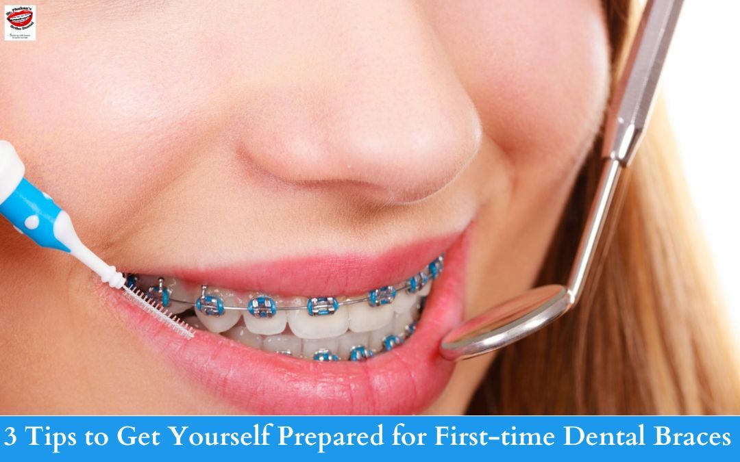 3 Tips to Get Yourself Prepared for First-time Dental Braces
