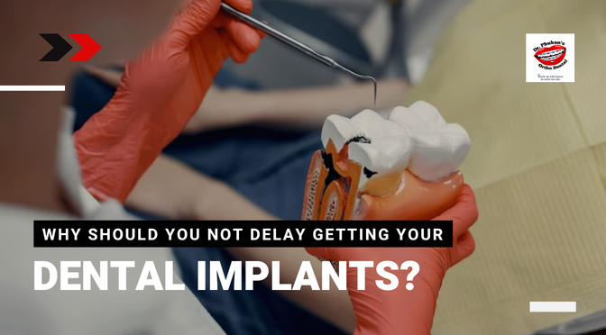 Why Should You Not Delay Getting Your Dental Implants?