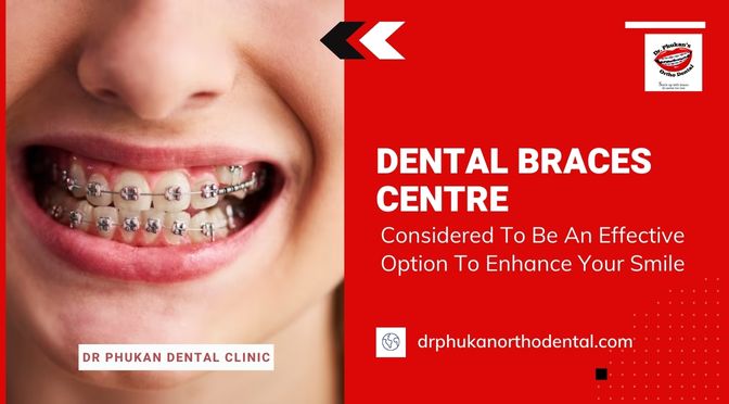 Why are Dental Braces Centre Considered To Be An Effective Option To Enhance Your Smile?