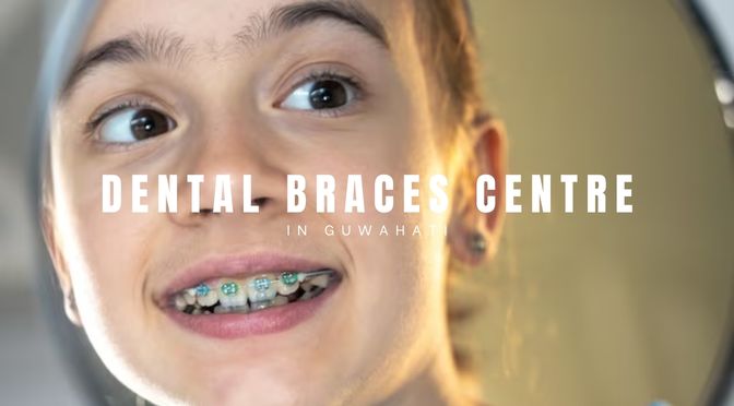 The Ultimate Guide to Find Best Dental Braces Centre in Guwahati